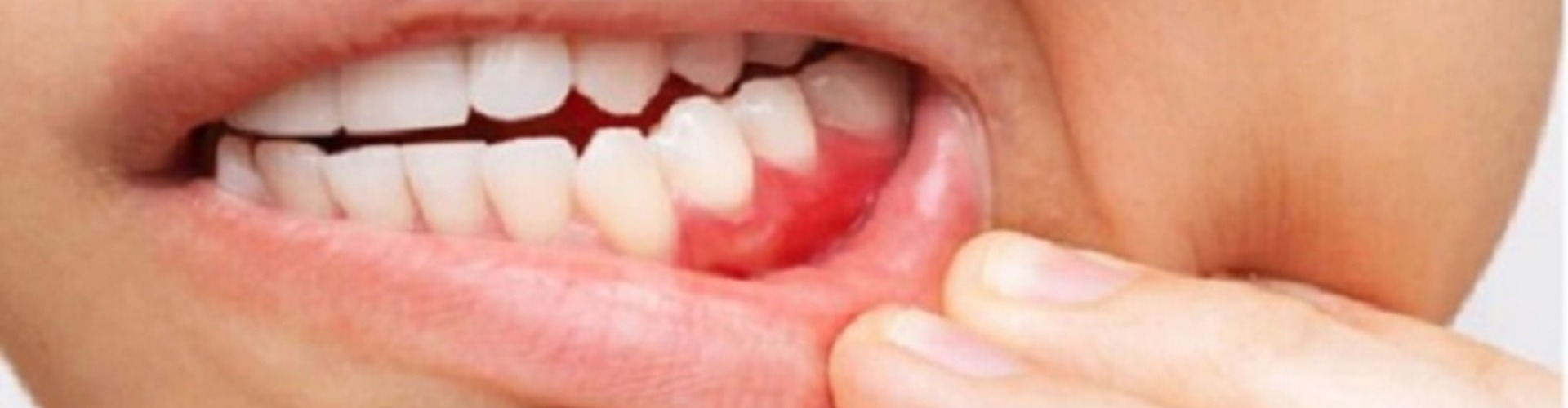 Burton Advance Dental cover photo